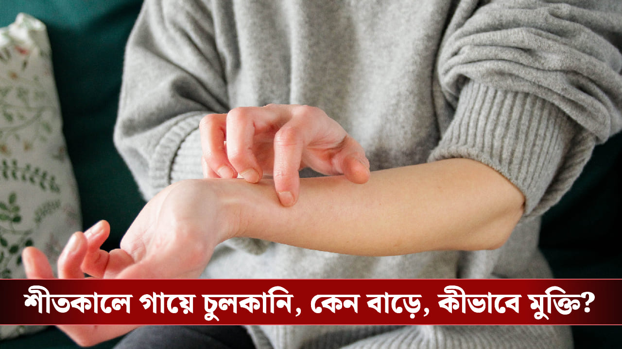 শীতে চুলকানির রহস্য কি? আর্দ্রতা ধরে রাখার কারণ, চিকিৎসা ও সহজ সমাধান জেনে নিন শীতে চুলকানির রহস্য কি? আর্দ্রতা ধরে রাখার কারণ, চিকিৎসা ও সহজ সমাধান জেনে নিন