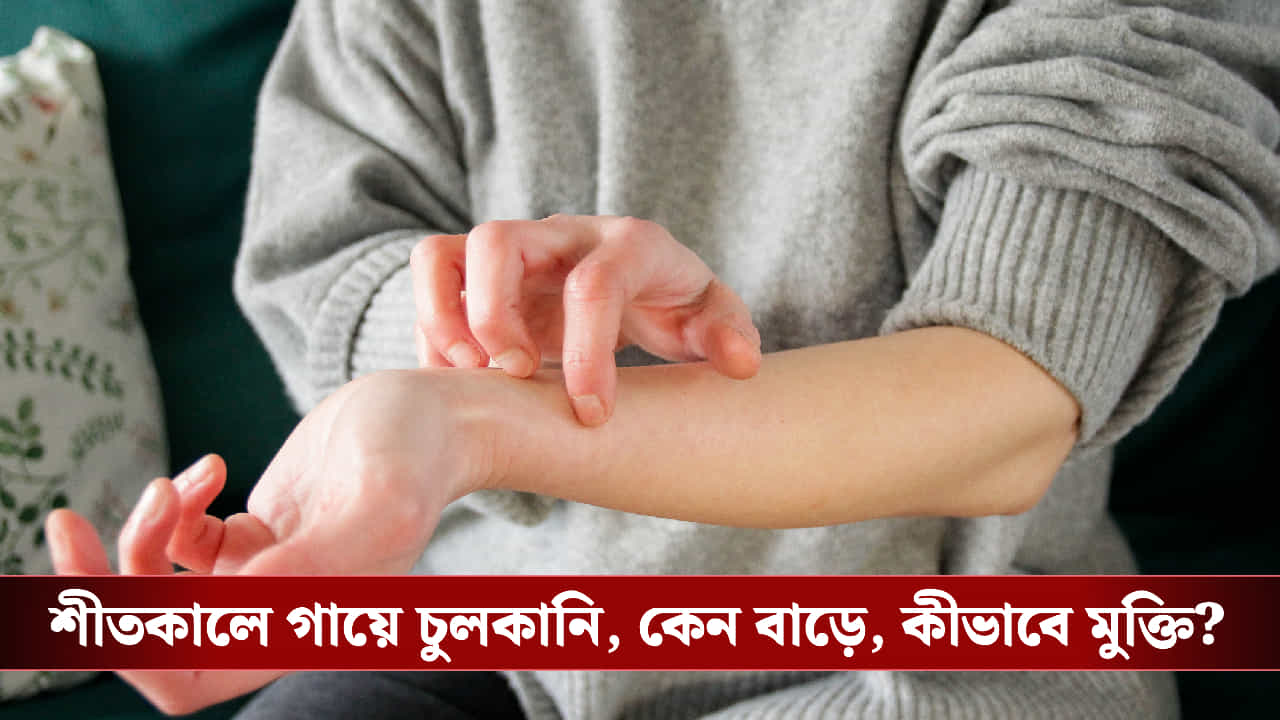 Winter Skin Care: শীতে গা চুলকানোর রহস্য কী? জানুন কারণ, প্রতিকার ও আর্দ্রতা ধরে রাখার সহজ কৌশল Winter Skin Care: শীতে গা চুলকানোর রহস্য কী? জানুন কারণ, প্রতিকার ও আর্দ্রতা ধরে রাখার সহজ কৌশল