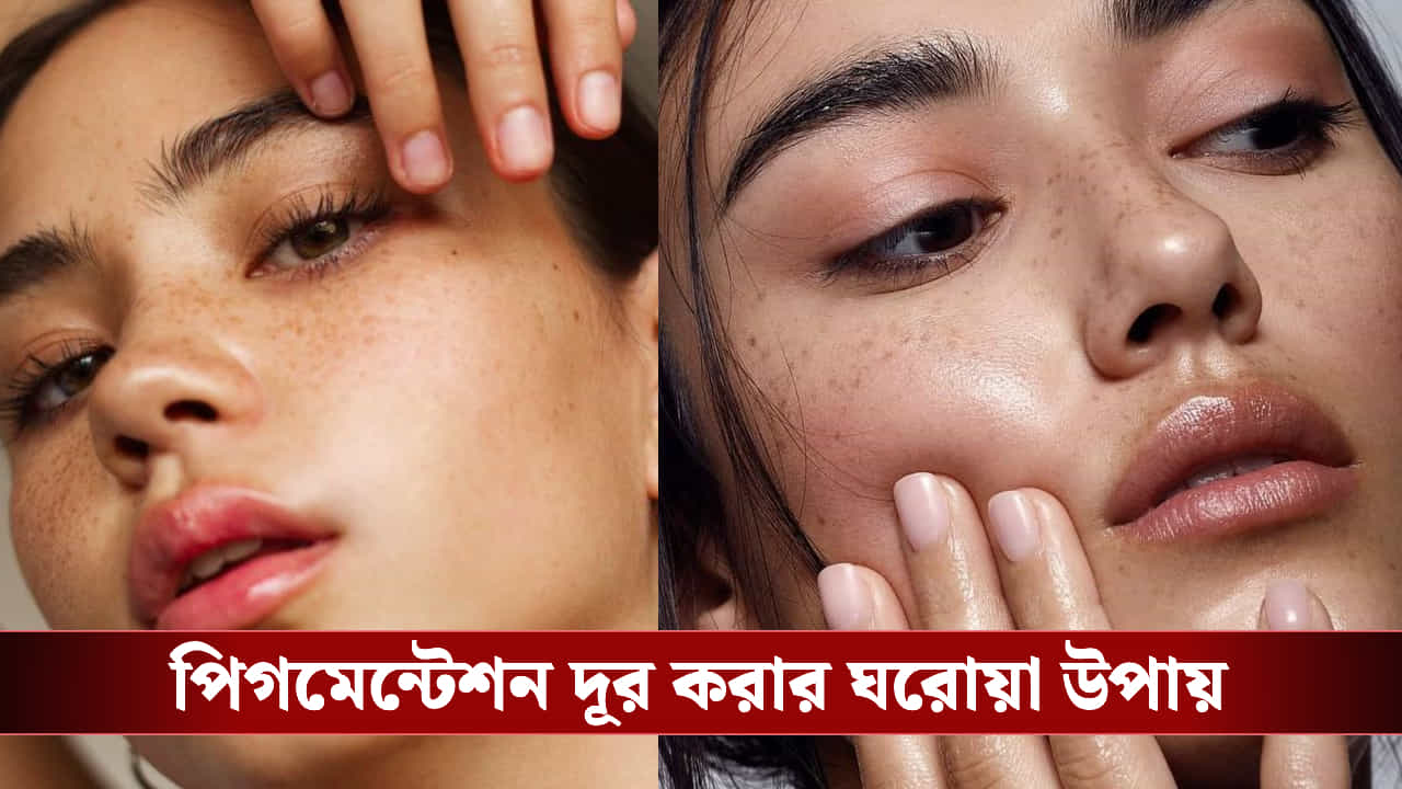 Pigmentation: দাগ-ছোপহীন ত্বক চান? এই উপায়ে ঘরে বসেই পিগমেন্টেশন দূর করে উজ্জ্বলতা ফেরান