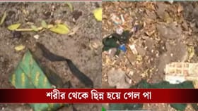 সাতসকালে স্কুল যাওয়ার পথে পড়ুয়ার পায়ের ওপর দিয়ে চলে গেল লরি