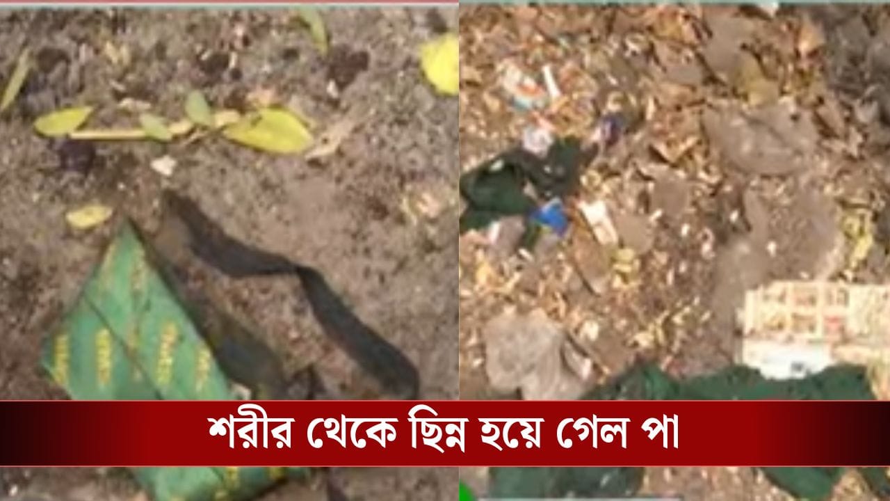 kankurgachi: সাতসকালে স্কুল যাওয়ার পথে পড়ুয়ার পায়ের ওপর দিয়ে চলে গেল লরি, গুরুতর জখম ছাত্র