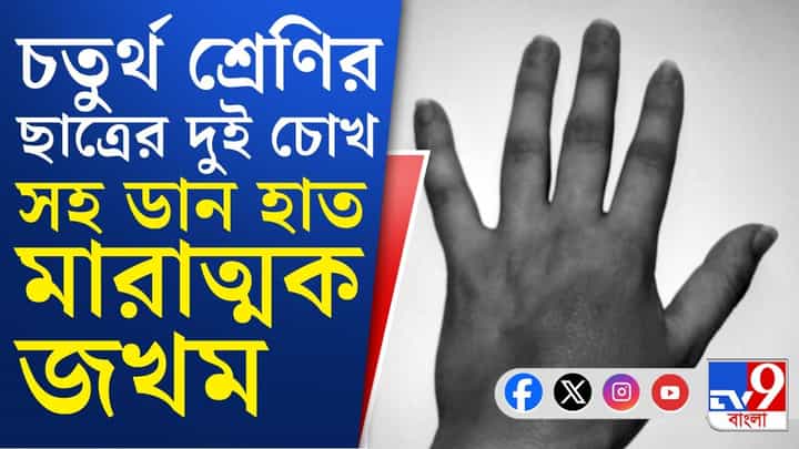 Bomb Blast: ফের বাংলায় বোমায় বিপন্ন শৈশব, ভয়ঙ্কর ঘটনা বাসন্তীতে Bomb Blast: ফের বাংলায় বোমায় বিপন্ন শৈশব, ভয়ঙ্কর ঘটনা বাসন্তীতে
