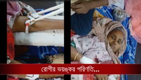 ভেঙেছে বাম পা! রোগীর সঙ্গে সরকারি হাসপাতালেই যা হল... বাকরুদ্ধ পরিবার