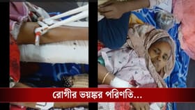 ভেঙেছে বাম পা! রোগীর সঙ্গে সরকারি হাসপাতালেই যা হল... বাকরুদ্ধ পরিবার