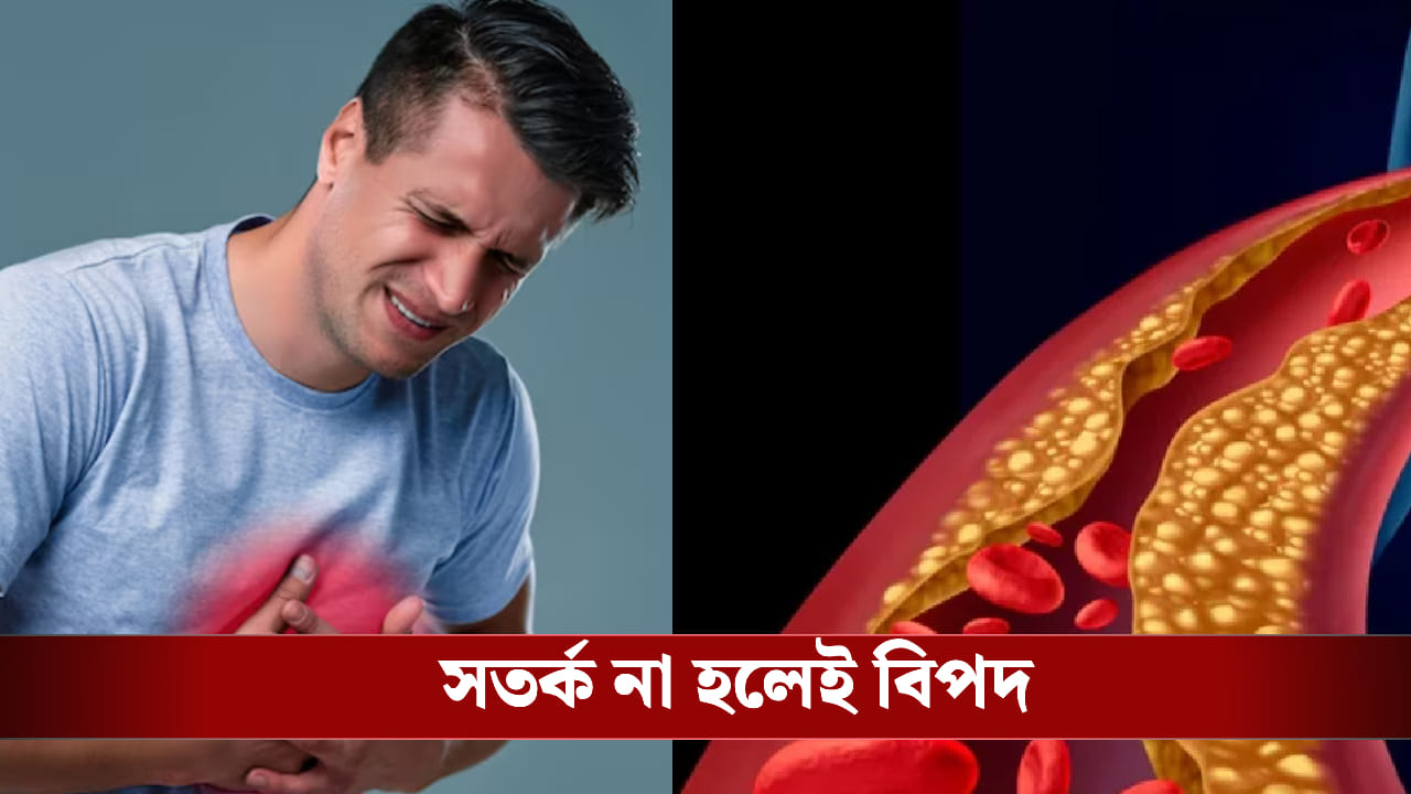 অতিরিক্ত কোলেস্টেরল! সকালের এই ৬ অভ্যাসেই হবে কেল্লাফতে অতিরিক্ত কোলেস্টেরল! সকালের এই ৬ অভ্যাসেই হবে কেল্লাফতে