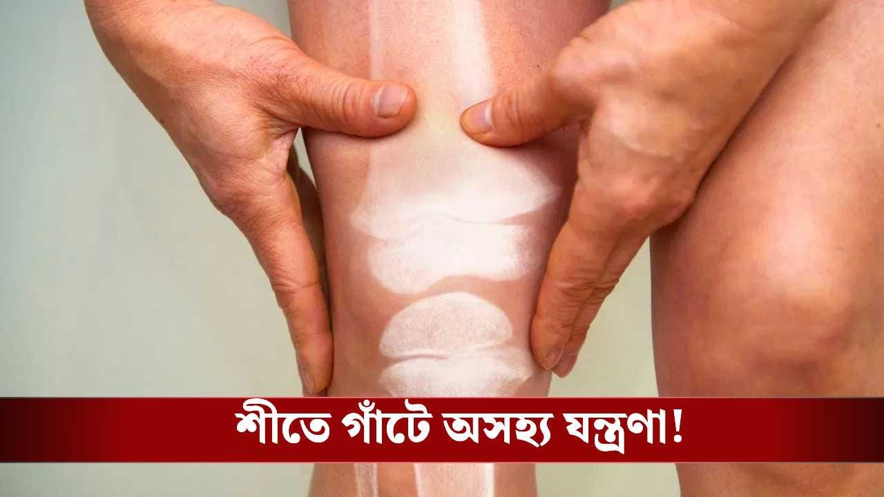 শীতের দাপটে গাঁটে অসহ্য যন্ত্রণা! কীভাবে মিলবে স্বস্তি? রইল টিপস