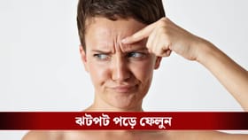 শীতকালে এটা নিয়মিত করলেই বলিরেখা হবে গায়েব!