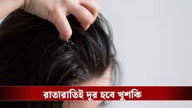 খুশকি নিয়ে নাজেহাল? তেল মাখার নিয়মটা বদলে ফেলুন