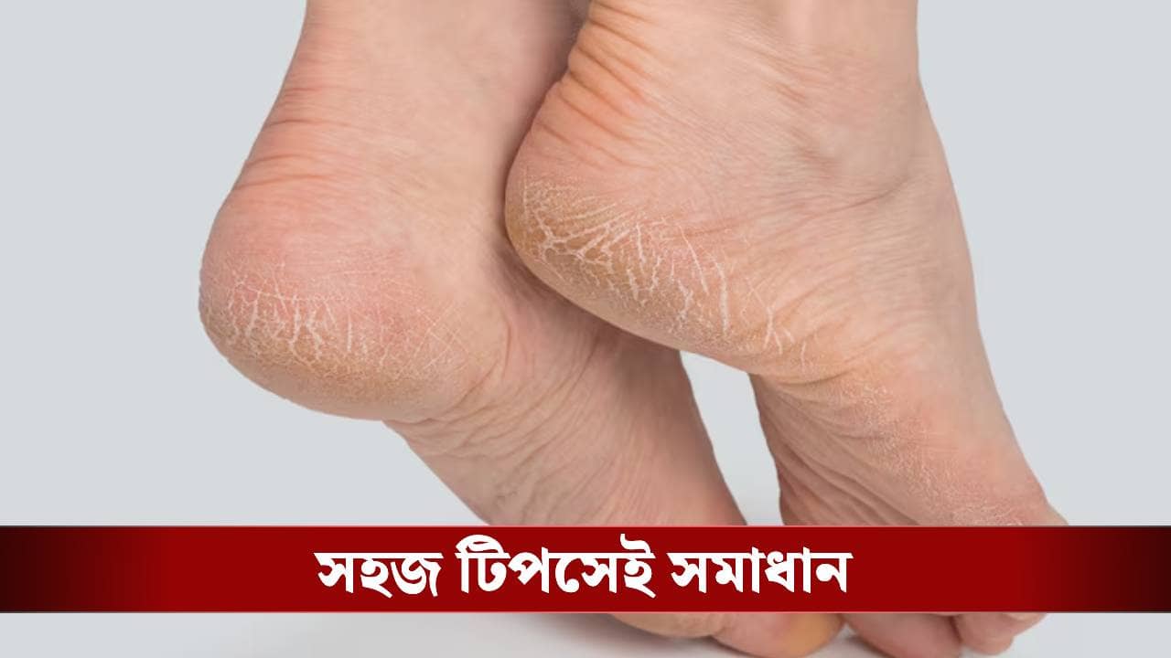 এই শীতেও তুলতুলে হবে পায়ের চামড়া, শুধু মেনে চলুন এই ম্যাজিক প্ল্যান