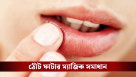 বাজার চলতি নয়, শীতে ভরসা রাখুন বাড়িতে তৈরি ‘ন্যাচারাল’ লিপ বামে