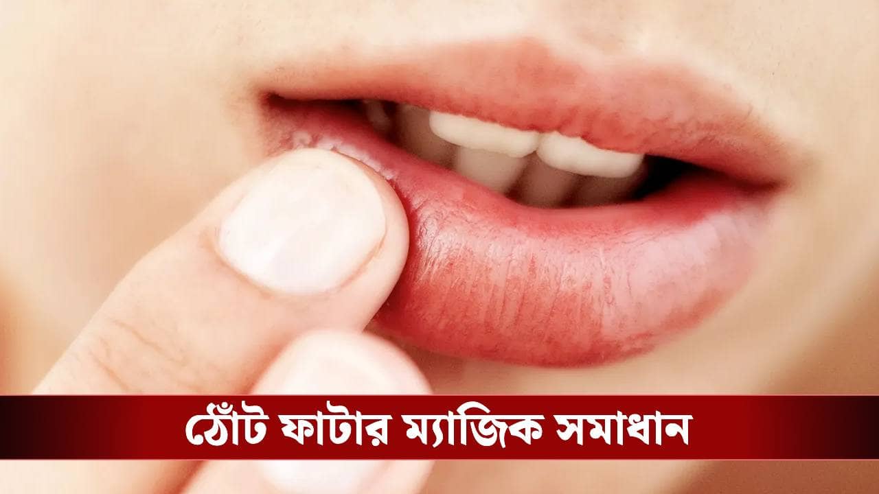 বাজার চলতি নয়, শীতে ভরসা রাখুন বাড়িতে তৈরি ‘ন্যাচারাল’ লিপ বামে