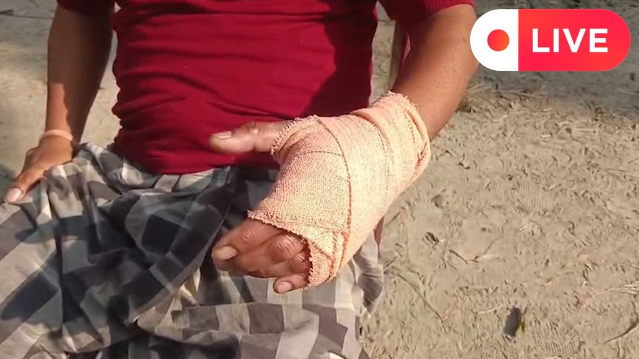 বোমায় ঝলসে গেল হাত, ভোটের আগে এ কী অবস্থা দেখুন