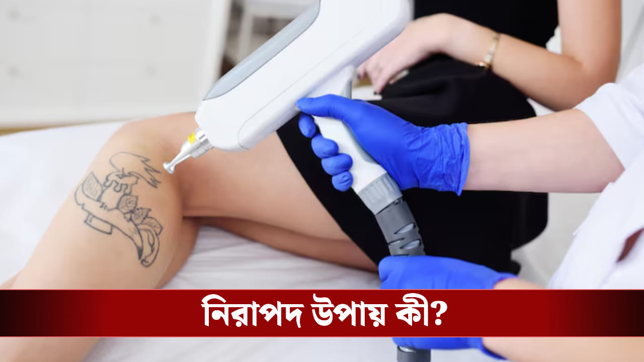 ট্যাটু তুলতে চান? লেজারের ভয়ে দূরে রয়েছেন? ঘরোয়া টোটকাতেই মুক্তি?