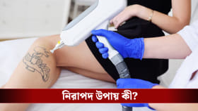 ট্যাটু তুলতে চান? লেজারের ভয়ে দূরে রয়েছেন? ঘরোয়া টোটকাতেই মুক্তি?