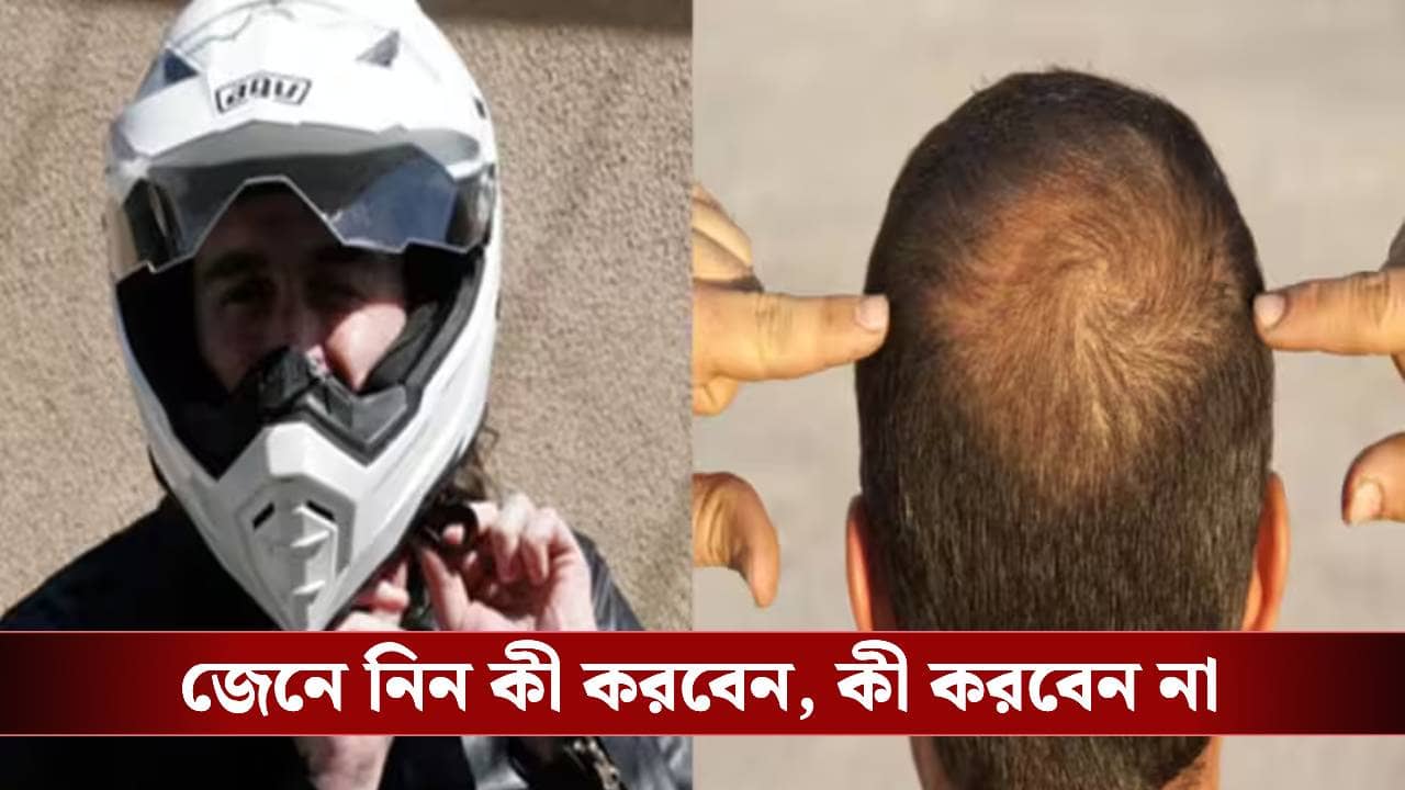 হেলমেট পরলেই কি চুল ঝরে? টাক পড়ার ভয় কতটা সত্যি, জানালেন বিশেষজ্ঞ