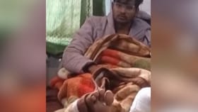 MBBS ডিগ্রি চাই-ই-চাই, কোটায় ভর্তি হতে নিজের পা-ই কেটে ফেললেন যুবক!