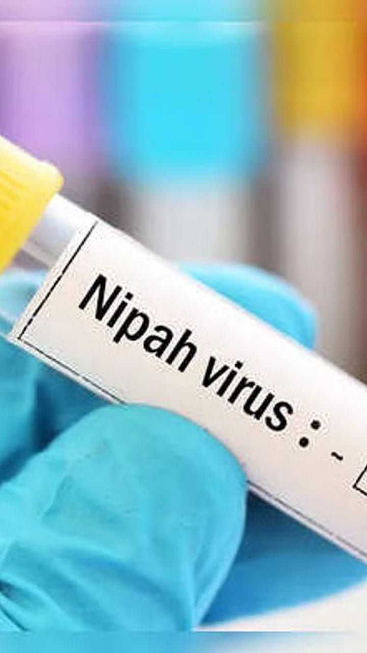 আপনি নিপা আক্রান্ত নন তো? জানুন উপসর্গ