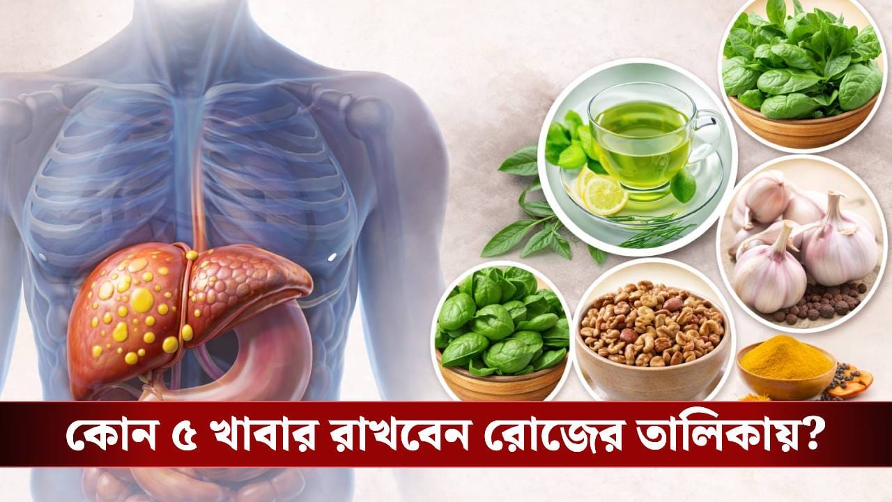 ফ্যাটি লিভার এখন ঘরে ঘরে! কোন খাবার খেলে কমবে বিপদ? ফ্যাটি লিভার এখন ঘরে ঘরে! কোন খাবার খেলে কমবে বিপদ?