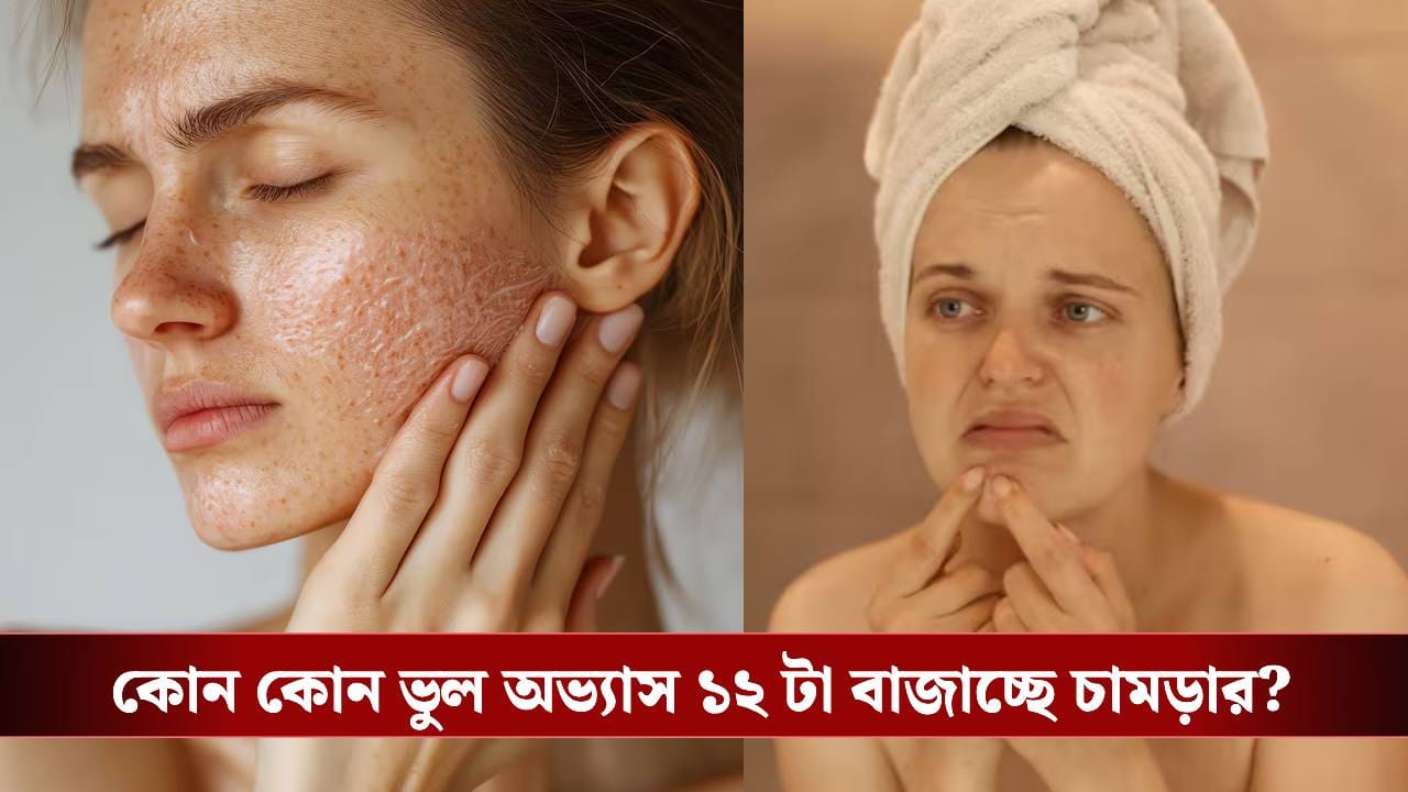 মুখে চামড়া খসে পড়ছে? সমস্যাটা শুধু শীতের নয়, অভ্যাসেও লুকিয়ে বিপদ মুখে চামড়া খসে পড়ছে? সমস্যাটা শুধু শীতের নয়, অভ্যাসেও লুকিয়ে বিপদ