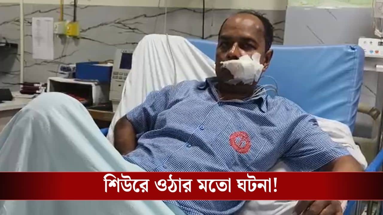 Hooghly: দোকান খুলতে যাচ্ছিলেন, দুভাগ হয়ে গেল মুখ! কীভাবে?