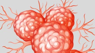 ক্যানসার চিকিৎসায় শরীরে পুষ্টি জোগাবে এই সব খাবার, আয়ুর্বেদের কথা বললেন রামদেব