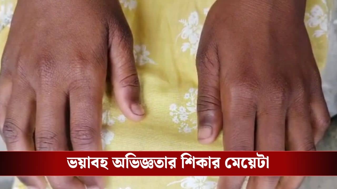 Basirhat: লজেন্সের লোভ দেখিয়ে নিয়ে গিয়েছিল দাদা, আমবাগান থেকে ফিরেই মাকে যা জানাল মেয়ে