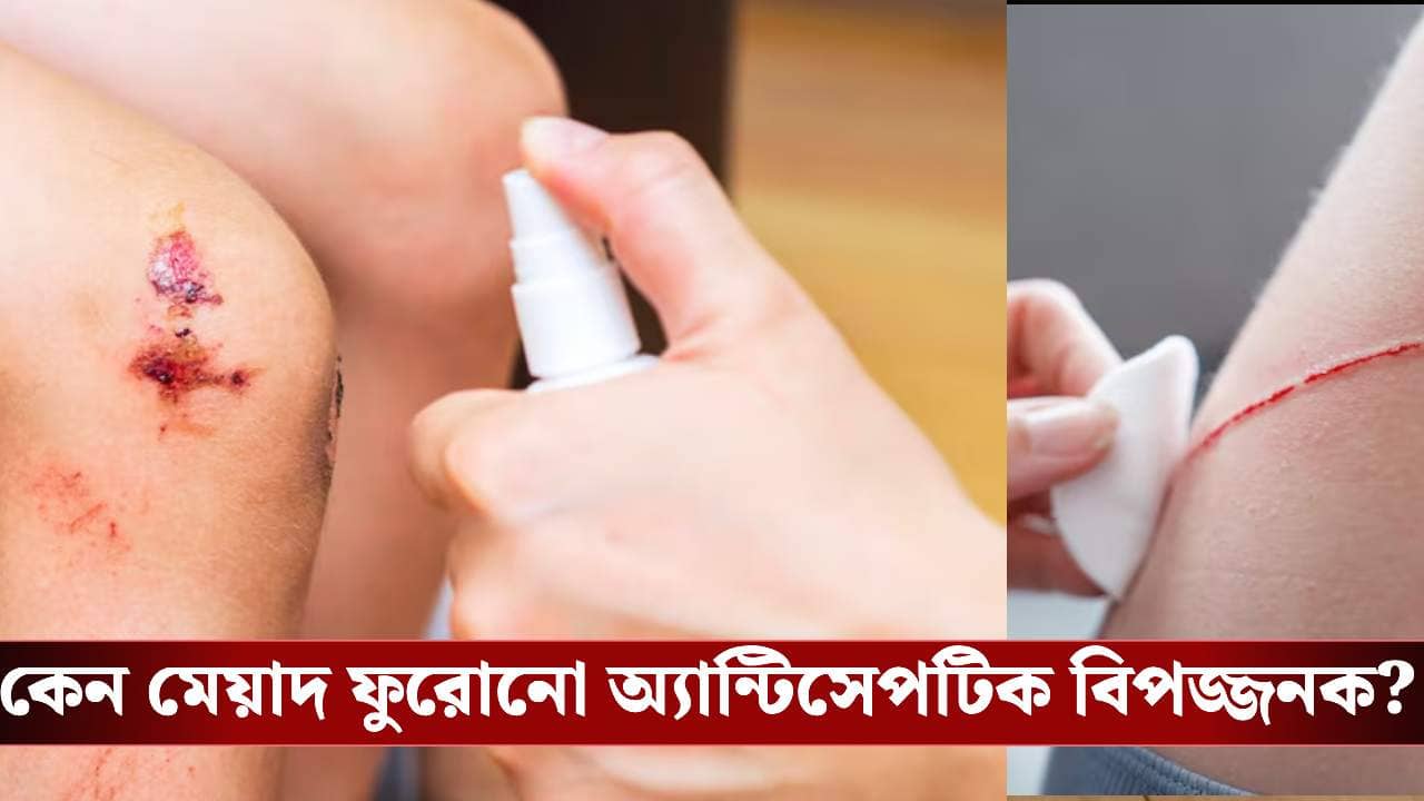 মেয়াদ ফুরোনো অ্যান্টিসেপটিক লাগাচ্ছেন? ছোট ক্ষতও হতে পারে বড় বিপদ!