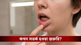 জিভ বা গালে ঘা! ক্যানসারের লক্ষণকে অবহেলা করছেন না তো?