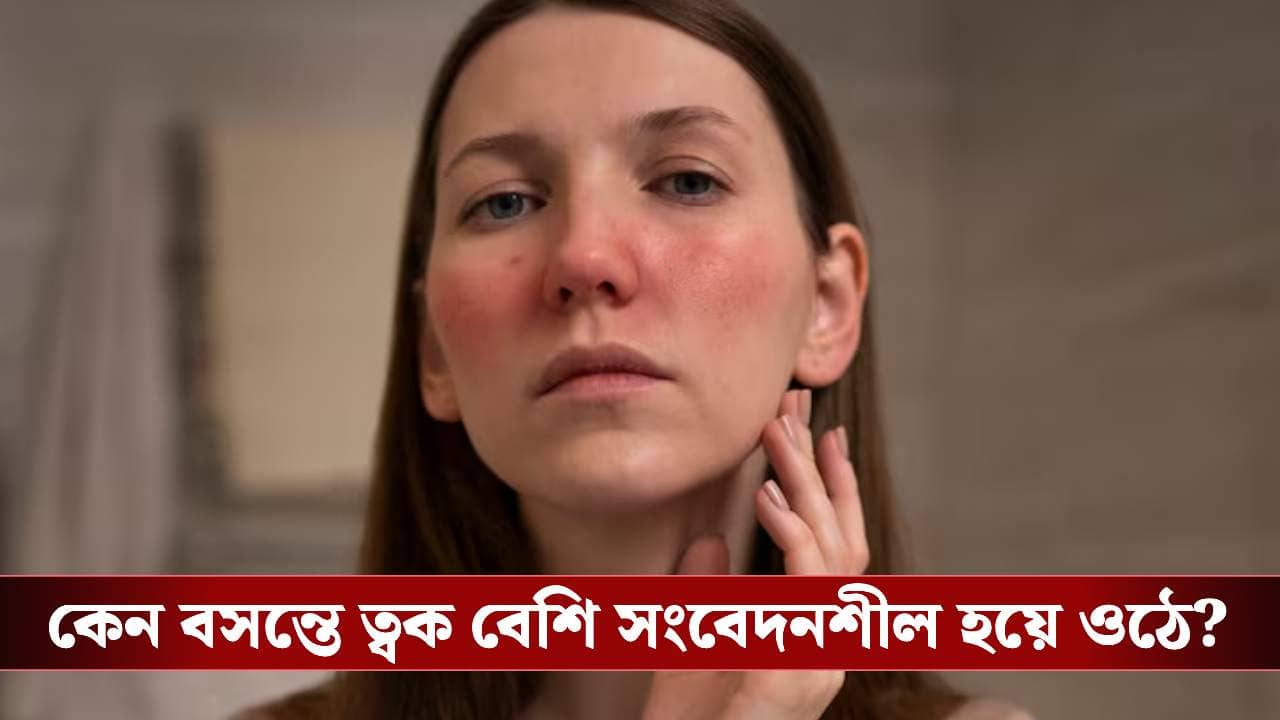 বসন্তের হাওয়ায় ত্বকে র‍্যাশ আর চুলকানি? চটজলদি আরাম পেতে ডায়েটে আনুন এই বদল