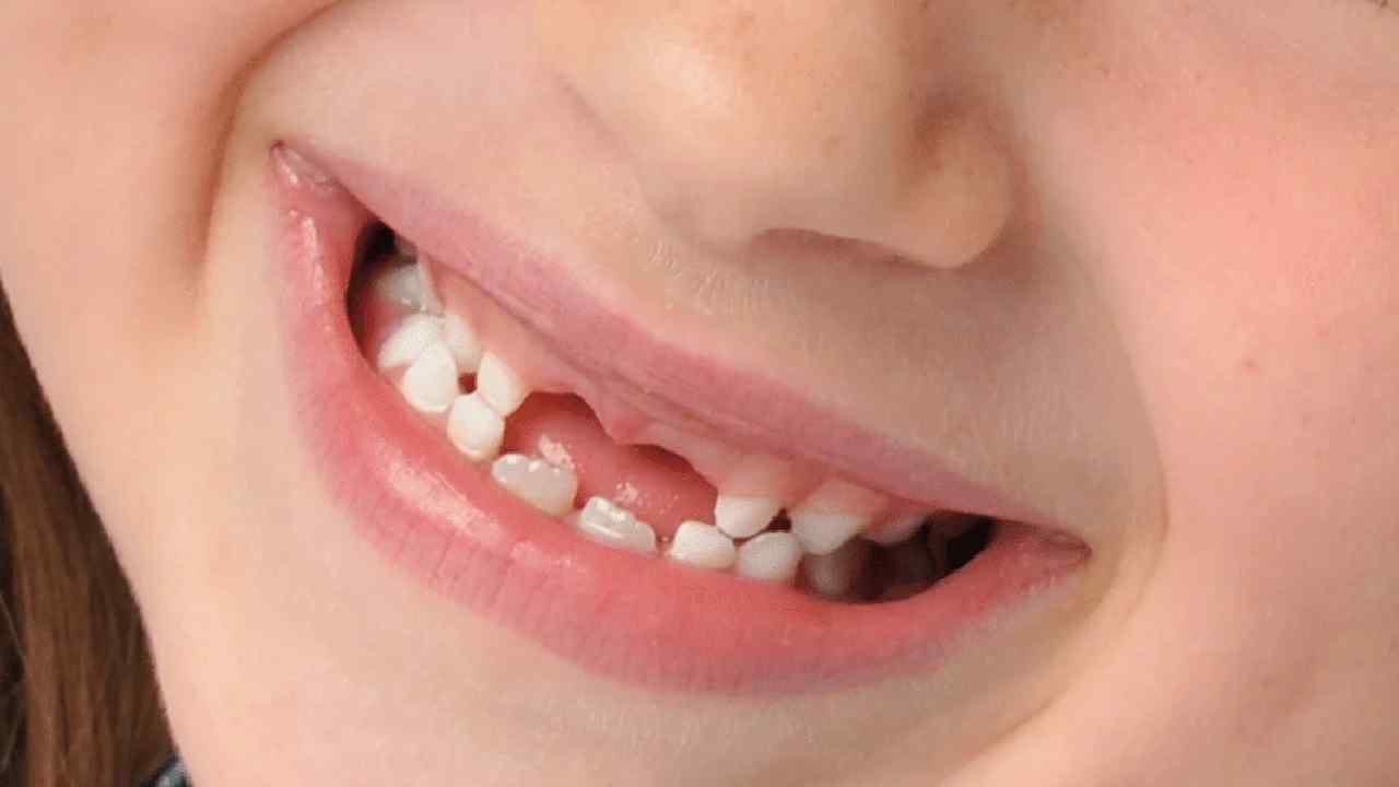 Japan Medicine: হাড় চিবোতে গিয়ে আর খুলবে না নকল দাঁতের পাটি, ওষুধ খেয়েই গজাবে নতুন দাঁত!