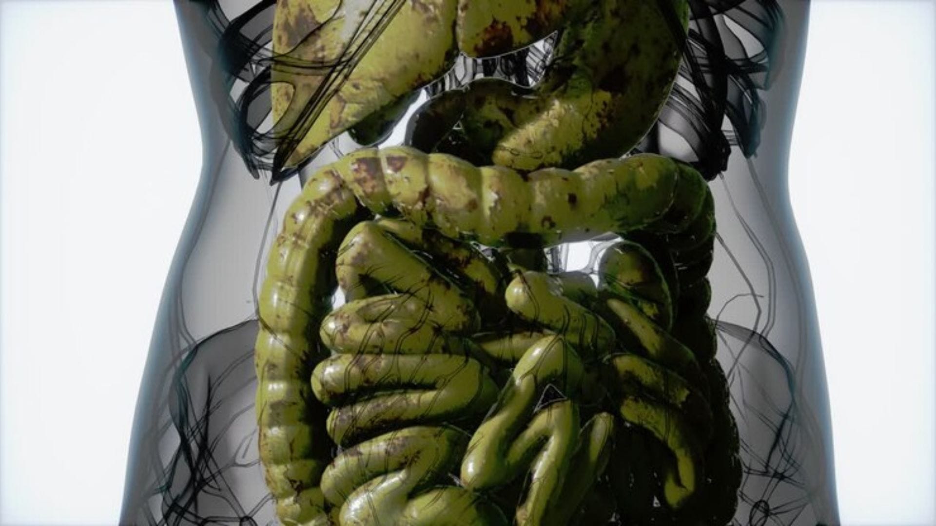 এতে থাকা এনজাইম এবং অ্যাসিড কোলোনের খারাপ ব্যাকটেরিয়া ধ্বংস করে। এক গ্লাস হালকা গরম জলে ১-২ চামচ অ্যাপেল সিডার ভিনেগার মিশিয়ে খেলে তা প্রাকৃতিক ক্লিনজার হিসেবে কাজ করে।