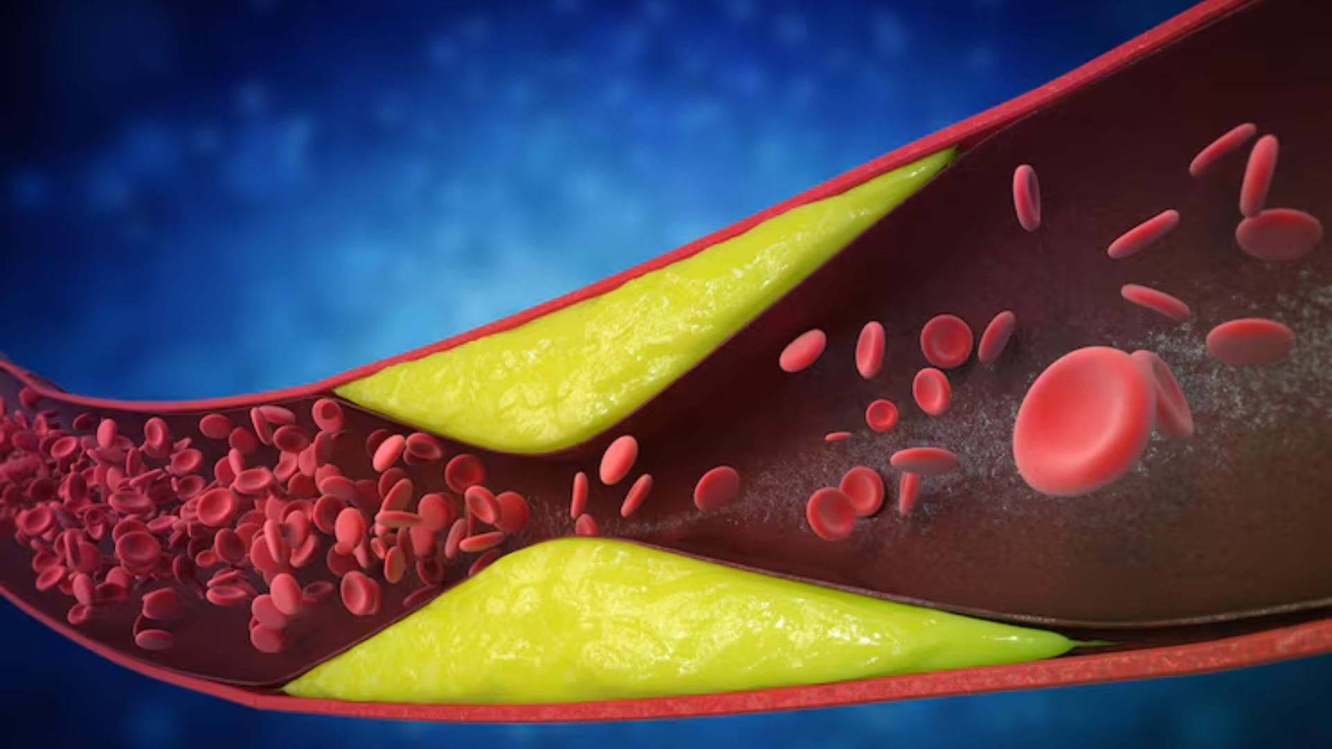 ফল ও সবজির ভূমিকা: প্রতিদিনের পাতে শসা, সবুজ শাকসবজি এবং ফল (যেমন- আপেল, কমলা) রাখুন। এগুলি ধমনী পরিষ্কার রাখতে সাহায্য করে।