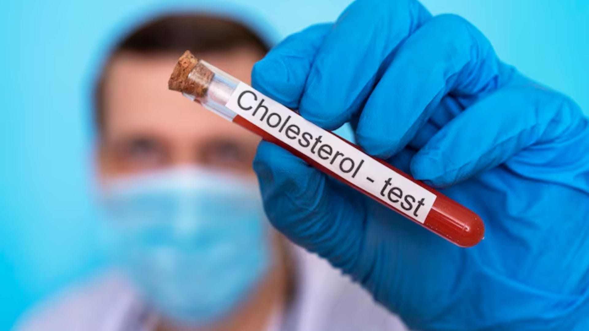 বর্জন করুন ট্রান্সফ্যাট: রেড মিট, ভাজাভুজি এবং বেকারি পণ্য (বিস্কুট, কেক) রক্তে খারাপ কোলেস্টেরল বাড়ায়; এগুলো যতটা সম্ভব এড়িয়ে চলুন।