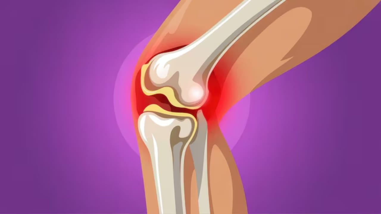 তীব্র ব্যথায় বা ফোলা কমাতে দিনে ২-৩ বার ১৫ মিনিটের জন্য বরফ দিতে পারেন। আর দীর্ঘদিনের পুরনো ব্যথা বা পেশির জড়তা কাটাতে গরম জলের সেঁক বেশ আরামদায়ক।