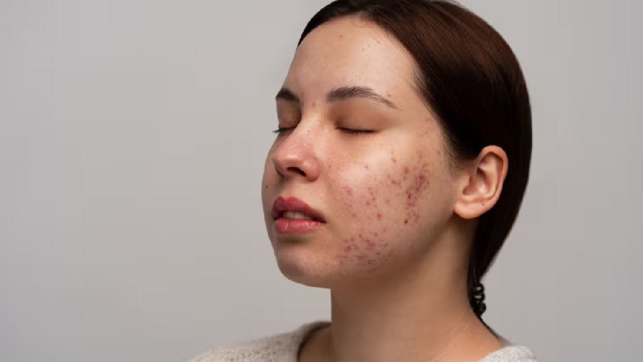 লবঙ্গ জল সরাসরি ত্বকে ব্যবহার করলে হিতে বিপরীত হতে পারে। ইউজেনল অত্যন্ত শক্তিশালী উপাদান হওয়ায় এটি থেকে ত্বকে জ্বালাপোড়া, র‍্যাশ বা রেডনেস দেখা দেওয়ার প্রবল সম্ভাবনা থাকে। Free Pik