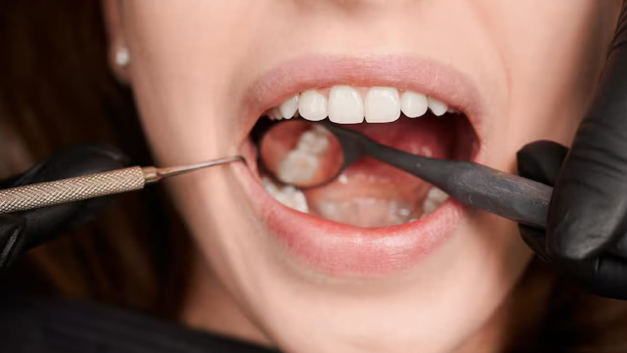 প্লাক জমা, ক্যাভিটি বা মাড়ির প্রাথমিক সমস্যার শুরুতে সাধারণত কোনও ব্যথা থাকে না। সাধারণ মানুষ এই লক্ষণগুলো সম্পর্কে সচেতন নন বলেই চিকিৎসায় দেরি হয়। পরে যখন ব্যথা শুরু হয়, তখন দেখা যায় সংক্রমণ অনেকটা গভীরে পৌঁছে গিয়েছে। Free pik