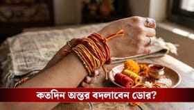 দিনের পর দিন বদলান না কবজির ডোর? হতে পারে ভয়ঙ্কর বিপদ!