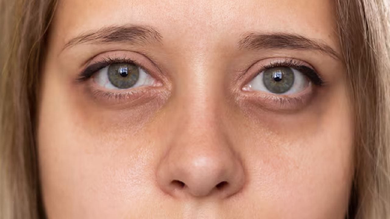 ব্রণর সমস্যা দূর করা হোক বা চোখের তলার কালি— বরফের জুড়ি মেলা ভার। মেকআপ করার আগে মুখে বরফ ঘষে নিলে ত্বক দীর্ঘক্ষণ সতেজ ও প্রাণবন্ত দেখায়। তবে সাধারণ বরফের চেয়ে মিশ্রিত বরফ আরও বেশি কার্যকর। Free Pik