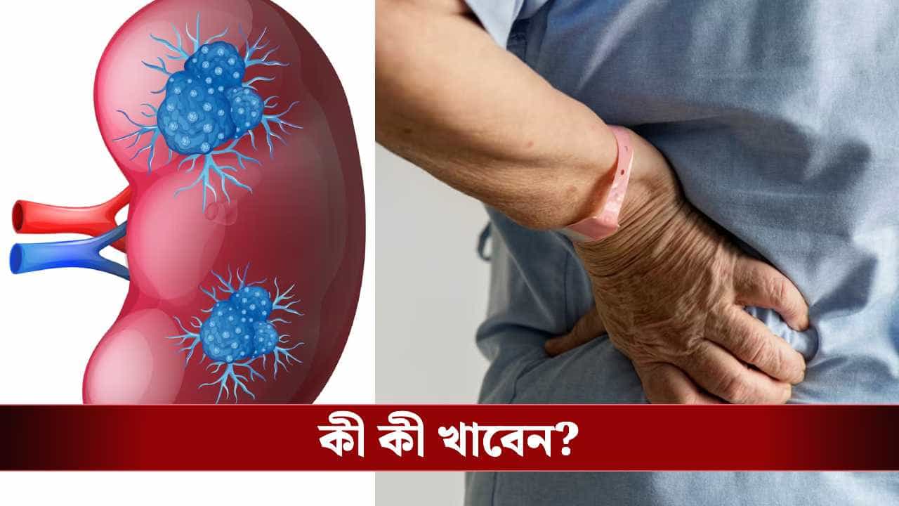কিডনি নিয়ে চিন্তায়? এই সবজি আর ফলেই কিডনি থাকবে তরতাজা কিডনি নিয়ে চিন্তায়? এই সবজি আর ফলেই কিডনি থাকবে তরতাজা
