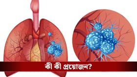 সিঁড়ি দিয়ে উঠলে কি দম ফুরিয়ে যাচ্ছে? ফুসফুস ঠিক আছে কিনা দেখে নিন