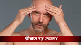 টাক পড়ার ভয়? পুরুষের হেয়ার কেয়ারে ম্যাজিক দেখাবে এই ৪ স্পেশাল তেল