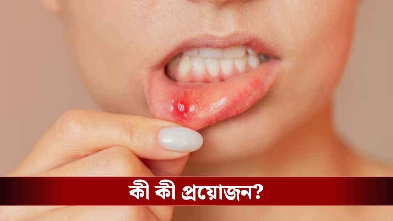মুখে ঘায়ে নাজেহাল? ঝাল খাওয়া শিকেয়? ঘরোয়া এই ৫ টোটকাতেই মিলবে ম্যাজিকের মতো আরাম!