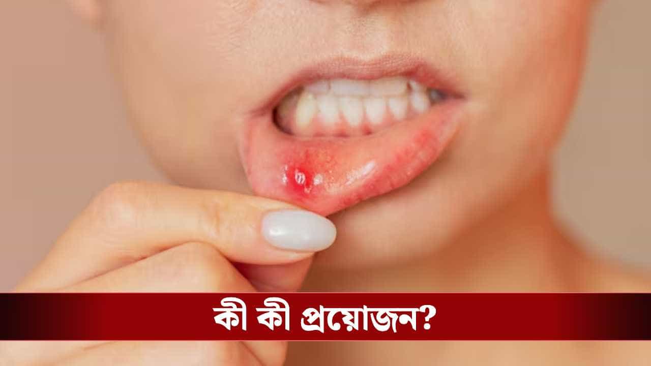 মুখে ঘায়ে নাজেহাল? ঝাল খাওয়া শিকেয়? ঘরোয়া এই ৫ টোটকাতেই মিলবে ম্যাজিকের মতো আরাম! মুখে ঘায়ে নাজেহাল? ঝাল খাওয়া শিকেয়? ঘরোয়া এই ৫ টোটকাতেই মিলবে ম্যাজিকের মতো আরাম!