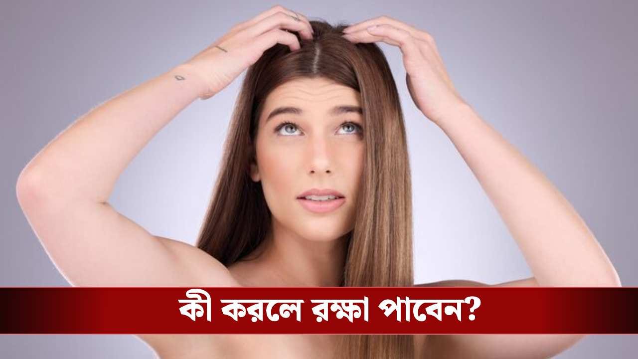 গরমে মাথার ত্বকে জ্বালাপোড়া আর চুলকানি? এই ঘরোয়া উপায়েই মিলবে আরাম