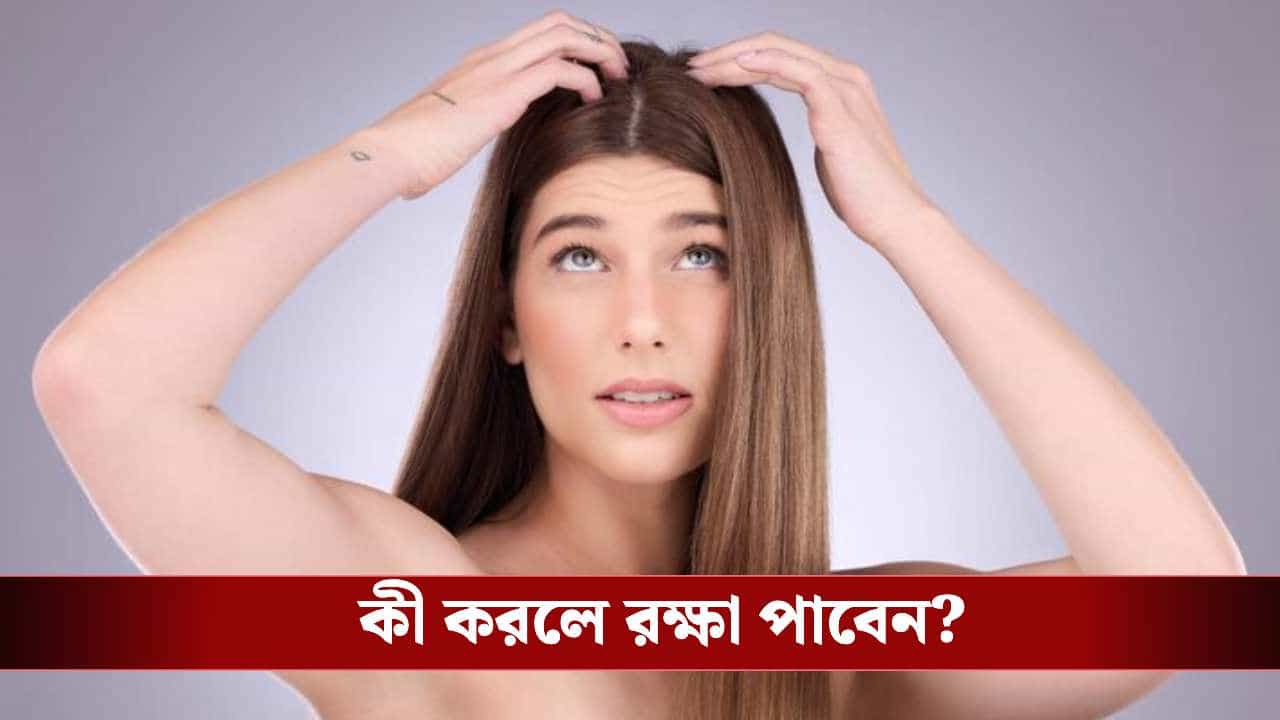 গরমে মাথার ত্বকে জ্বালাপোড়া আর চুলকানি? এই ঘরোয়া উপায়েই মিলবে আরাম গরমে মাথার ত্বকে জ্বালাপোড়া আর চুলকানি? এই ঘরোয়া উপায়েই মিলবে আরাম