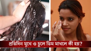 Eggs benefits: চুলের খুশকি কমায়, চামড়ার বলিরেখা দূর করে, ডিম মাখার উপকারিতা জেনে নিন