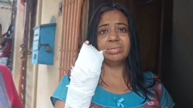 বরানগরে বিজেপি নেতাকে বাড়ির সামনেই ভোজালির 'কোপ'! আক্রান্ত দিদিও