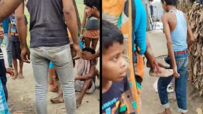 বল ভেবে খেলতে গিয়ে বোমা বিস্ফোরণ হয়ে আহত শিশু