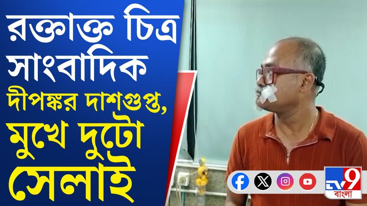 CJP Protest in Kolkata: এলোপাথাড়ি ইট-বোতল ও লাঠির মাঝে পড়ে আহত একাধিক সাংবাদিক