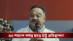 ৬০ শতাংশ পর্যন্ত ছাড়ে হাঁটু প্রতিস্থাপন! কল্যাণীতেই রোবোটিক সার্জারি